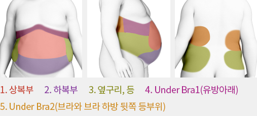 허쉬성형외과 코라인