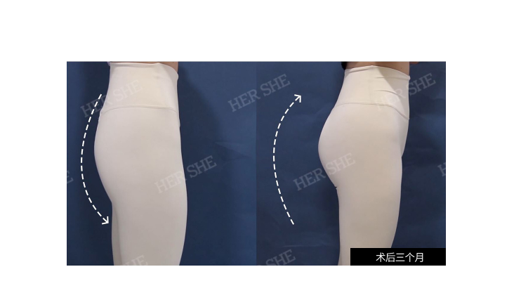 c8668b82799fe540348d8ae32fba7f95.png