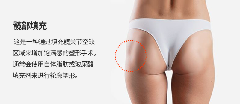 30db89ca3118b87e33fa4a092fd111d6.png