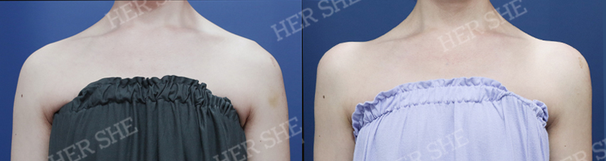 BEFORE & AFTER