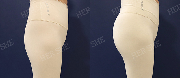 Butt filler before and after