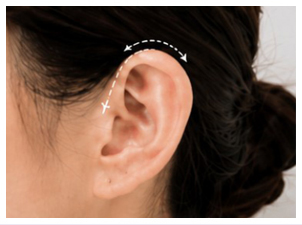 Front Auricular Rim