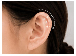 Outer Auricular Rim