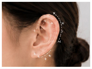 Overall Ear Size and Shape